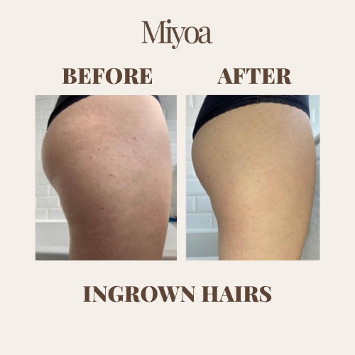 Silk Exfoliating Glove | Instantly Soft Skin