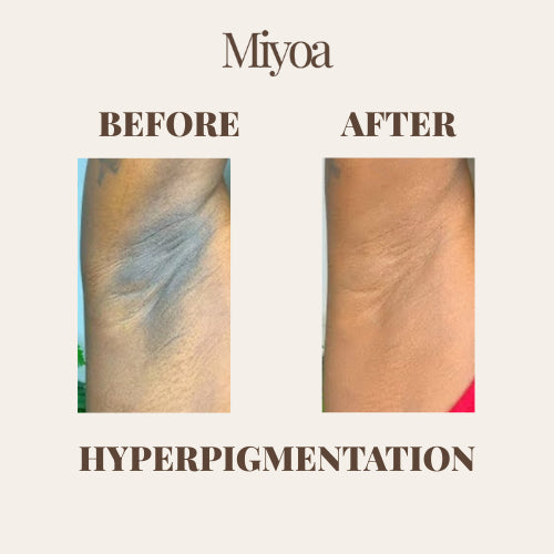 Silk Exfoliating Glove | Instantly Soft Skin