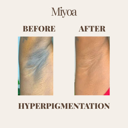 Silk Exfoliating Glove | Instantly Soft Skin